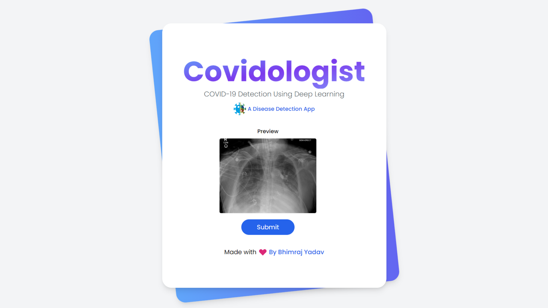 Covidologist : A Disease Detection Web App to assist radiologists to detect the presence of COVID-19.
